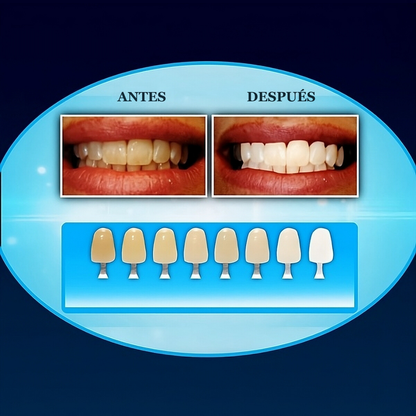 Kit Blanqueador Dental UV- LumiSmile™ - Wortek